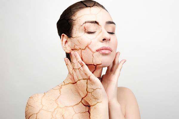 Bật mí cách trị da khô toàn thân bằng mẹo dân gian