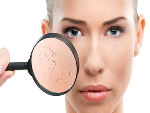 7 bước chăm sóc da khô đúng cách tại nhà