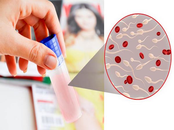 Dấu hiệu vô sinh nam